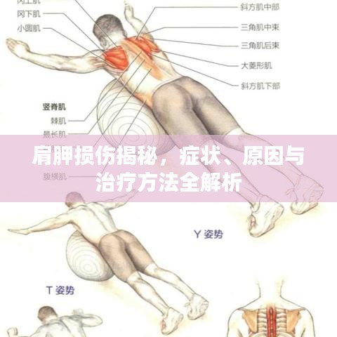 肩胛损伤揭秘，症状、原因与治疗方法全解析