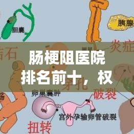 肠梗阻医院排名前十，权威医疗资源与治疗策略选择指南